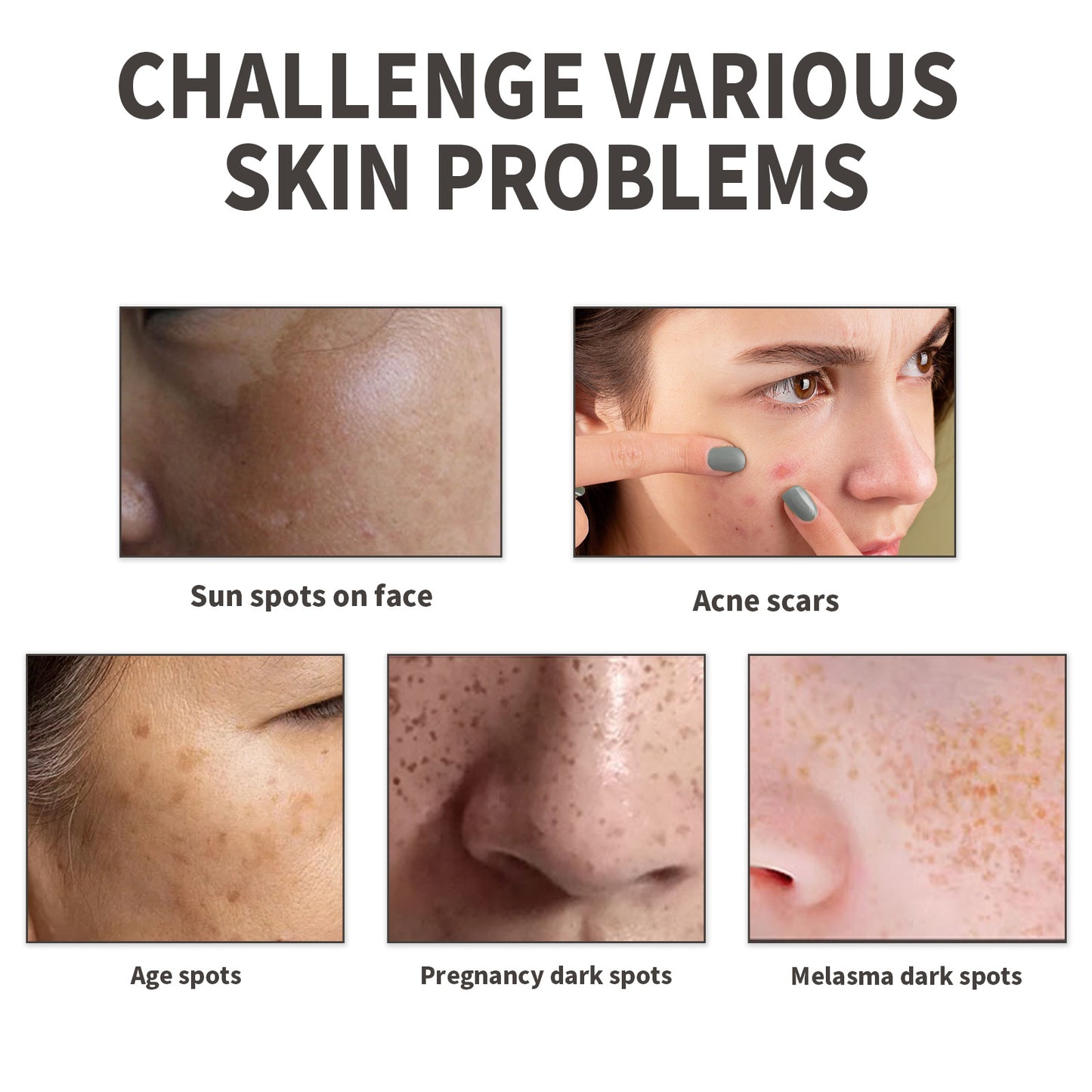 Diminish Spots And Acne Scars, Moisturize The Skin, Hydrate And Moisturize Daily Skincare