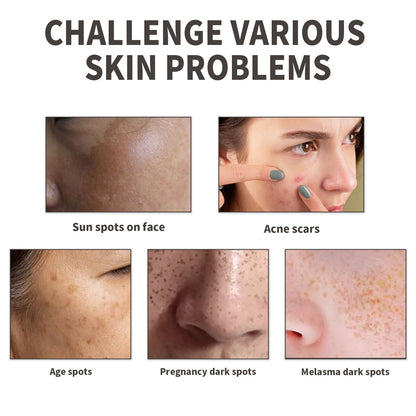 Diminish Spots And Acne Scars, Moisturize The Skin, Hydrate And Moisturize Daily Skincare